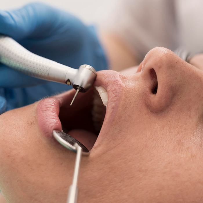 Eine Patientin lässt sich eine Composite‑Füllung machen